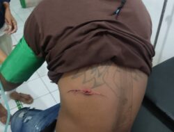 Akibat Konsumsi Minuman Keras, Terduga Pelaku Parangi Sesama Warga di Desa Wakpapapi