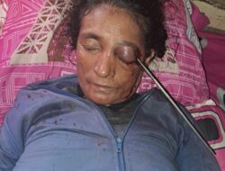 Akibat Lalai Sang Menantu Berakibat Ibu Mertua Terkena Panah, Polisi Turun TKP Tangani Insiden Tersebut